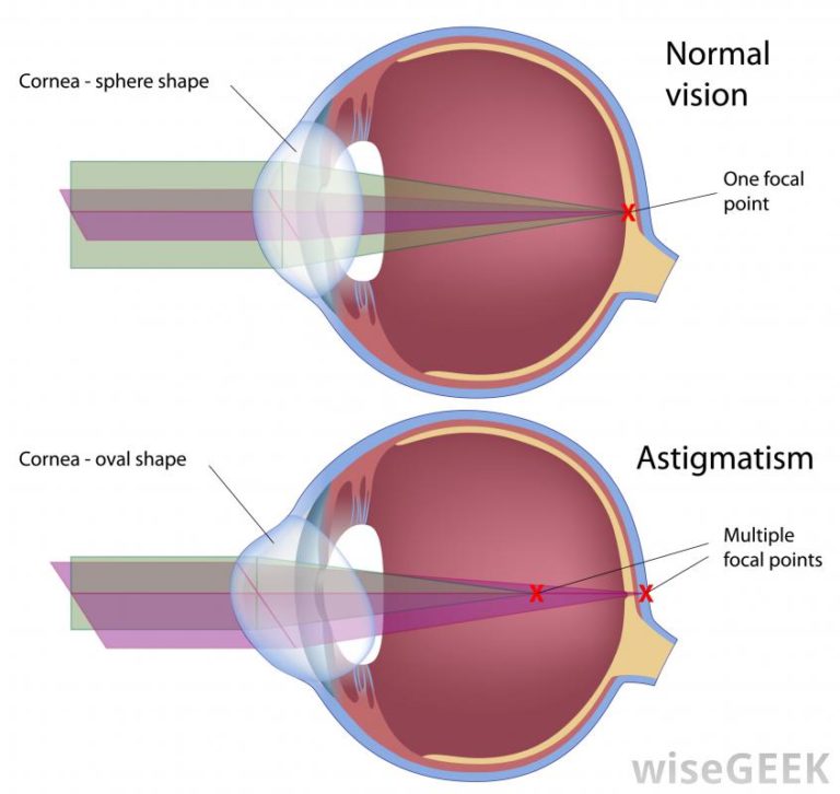 How much do toric lenses cost