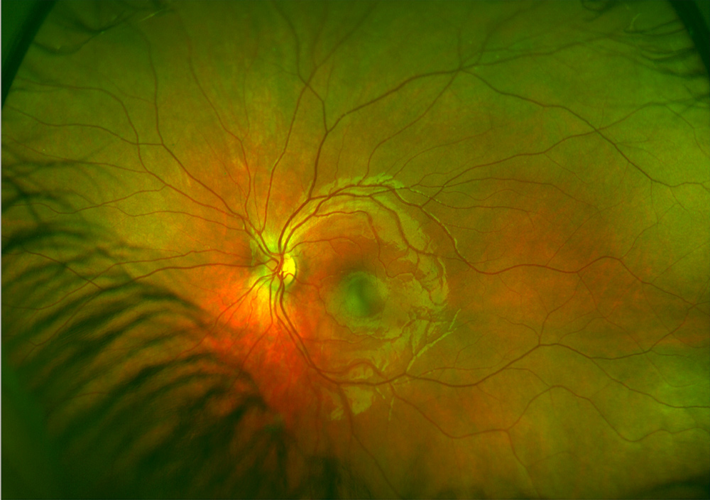 Medical Eye Exams Explained
